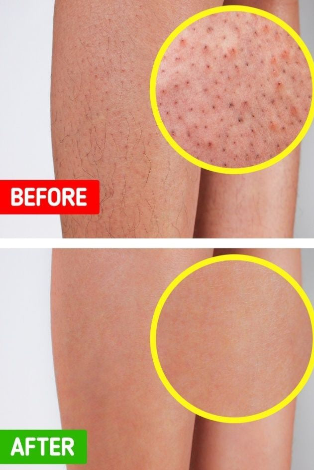 🌃🌟Glazina Charcoal Whipped - 250g Exfoliating Body Scrub For Sensitive Skin - Infused with Glycolic Acid (AHA) 🌃🌟